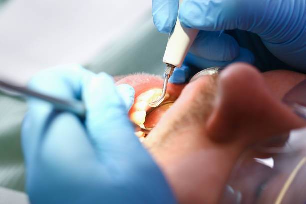 Best Knocked-Out Tooth Emergency  in Baltic, SD